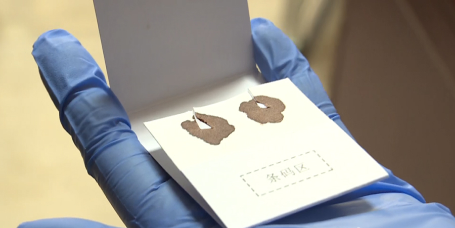 山东司法亲子鉴定需要怎么做,司法亲子鉴定采集哪些样本