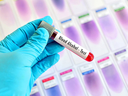 山东省亲子鉴定哪家机构比较好，山东省亲子鉴定需要什么手续