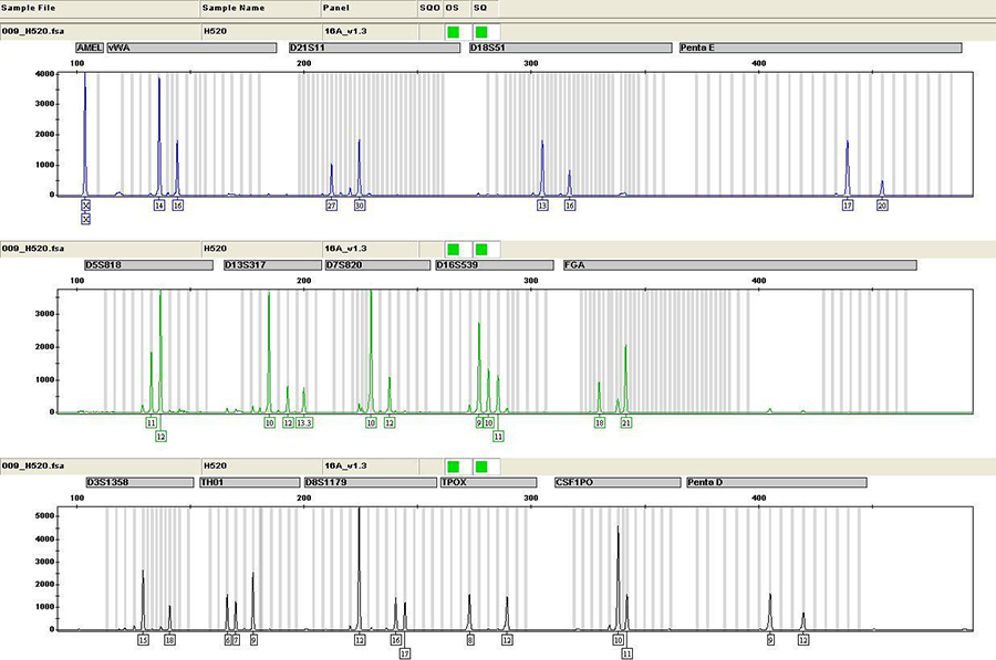 山东如何选择正规的亲子鉴定机构,山东正规的亲子鉴定办理费用