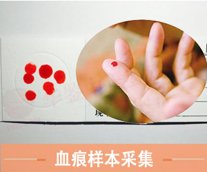 山东血痕样本采集方法