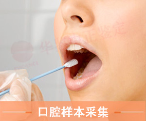 山东口腔拭子采集方法