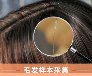 山东毛发样本采集方法
