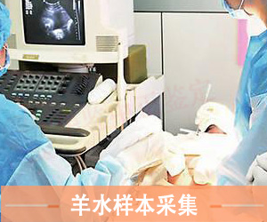 山东羊水样本采样方法
