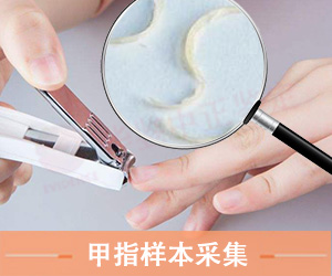 山东指甲样本采集方法